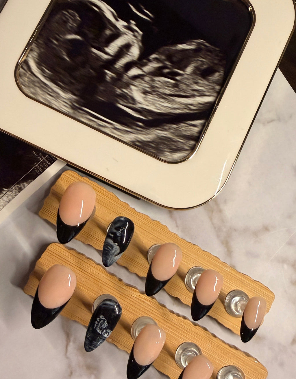 Ultrasound Nails